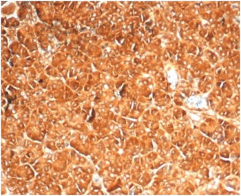 VCL Antibody