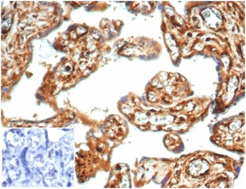 VCL Antibody