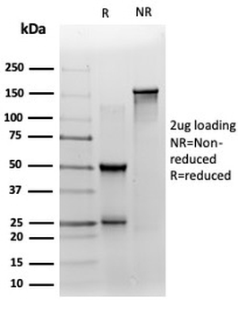 ZNF358 Antibody