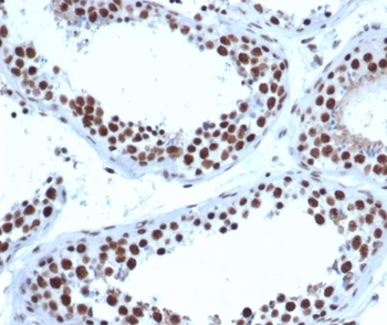 JAZF1 Antibody