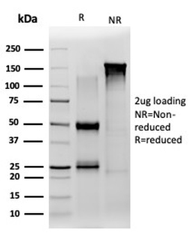 JAZF1 Antibody
