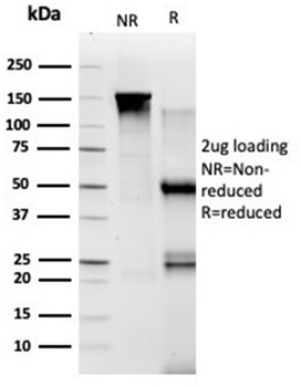 TADA1 Antibody