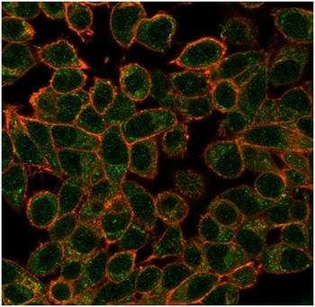 ECD Antibody