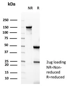 CKB Antibody