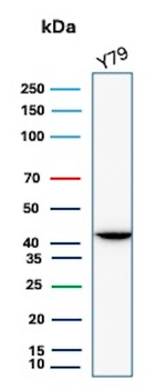 CKB Antibody