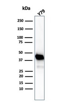 CKB Antibody