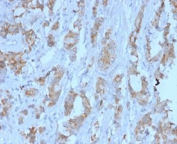 TDRKH Antibody