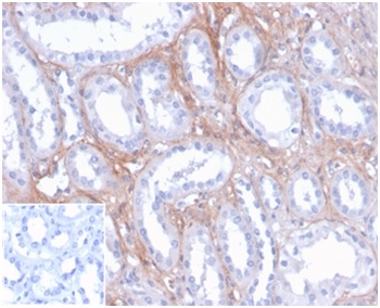 FGF23 Antibody