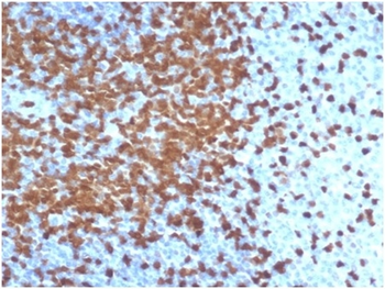 ZAP70 Antibody