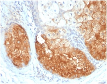 TYR Antibody
