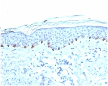 TYR Antibody