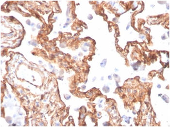 SPTAN1 Antibody