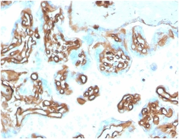 SPTAN1 Antibody