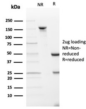 SPARC Antibody