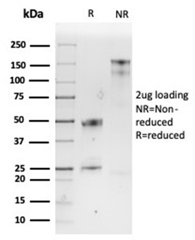 SPARC Antibody