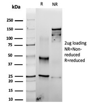 FSCN1 Antibody