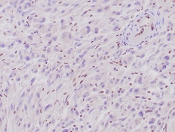 SMARCB1 Antibody