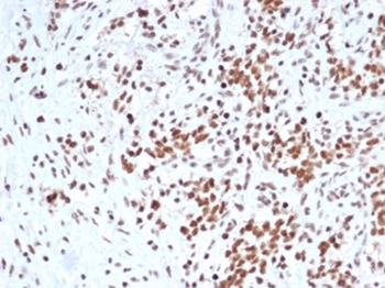 SMARCB1 Antibody