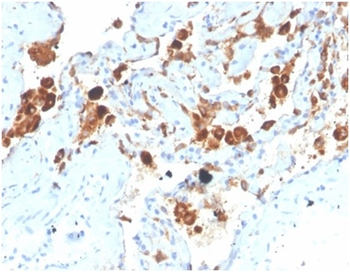 SFTPD Antibody