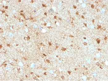 S100B Antibody