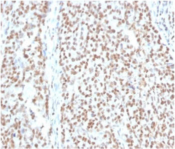 Replication Protein A2 (RPA2) Antibody