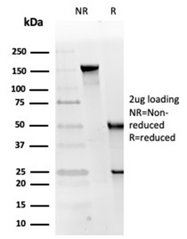 Replication Protein A2 (RPA2) Antibody