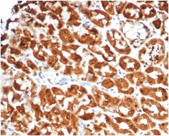 IL-2 Antibody