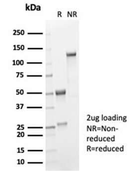 IL-2 Antibody