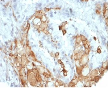 IL-2 Antibody