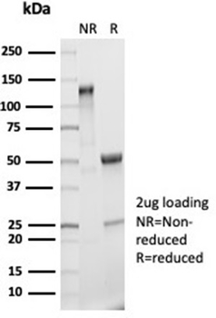 IL-2 Antibody