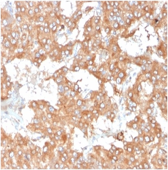IL-2 Antibody