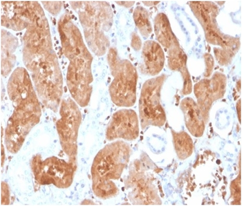IL-2 Antibody