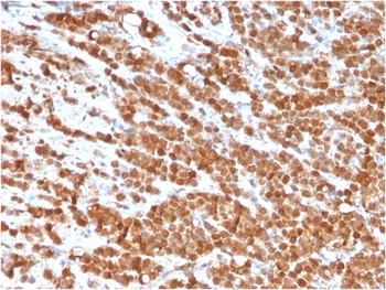 IL-2 Antibody
