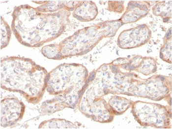 IGFBP3 Antibody