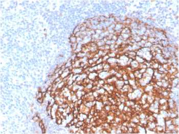 CR2 Antibody