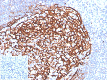 CR2 Antibody