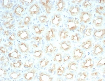CFTR Antibody