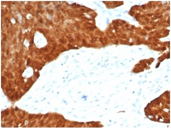 CDKN2A Antibody