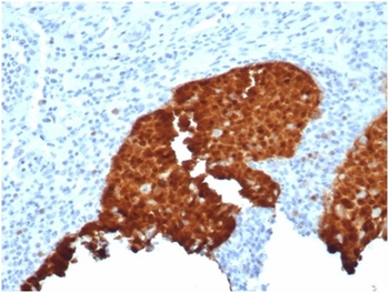 CDKN2A Antibody