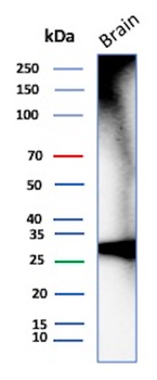 CALB2 Antibody