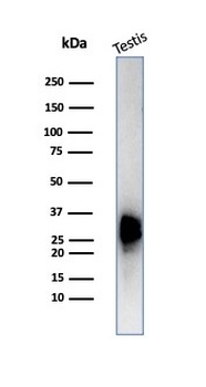 CALB2 Antibody