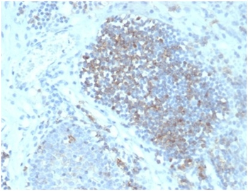 FASLG Antibody