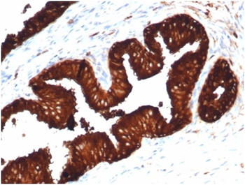 KLK3 Antibody