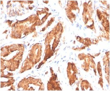 KLK3 Antibody