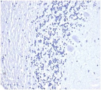 KLK3 Antibody