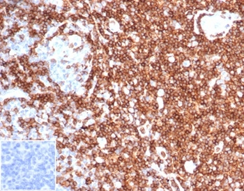 SPN Antibody