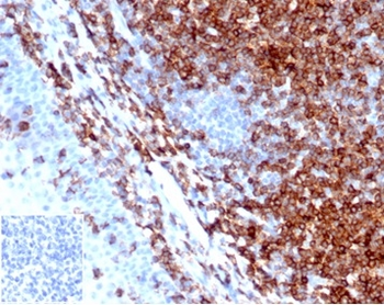 SPN Antibody