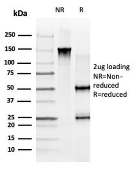 GLIS3 Antibody
