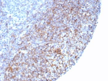 CR1 Antibody