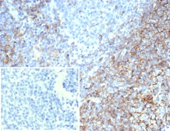CR1 Antibody